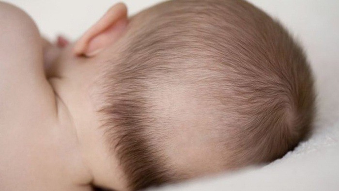 Trẻ 3 tháng tuổi bị rụng tóc có sao không?